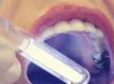 Oral Cancer Screening in Kingman