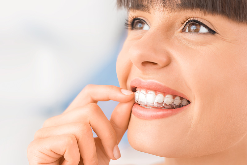Invisible Braces in Kingman