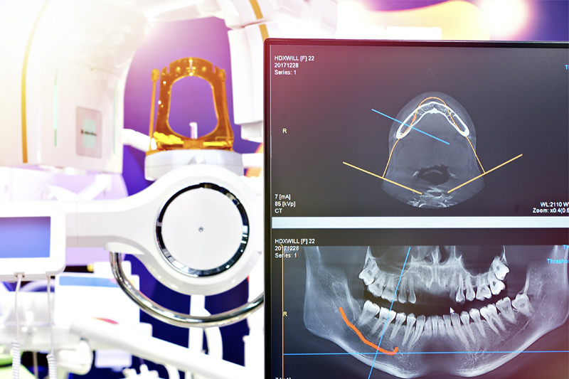Digital X-Rays in Kingman