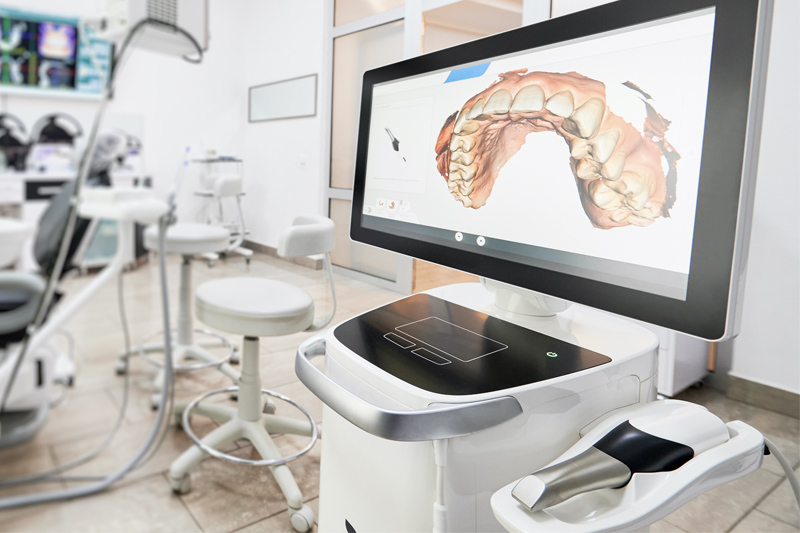 Intra-Oral Scanner in Kingman